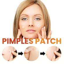 40/100 片可爱熊猫蛋糕痘痘贴，痘痘贴可遮盖痘痘和瑕疵，温和清洁身体皮肤贴，节日礼物 - 粉色 - 查看 5