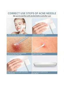 1个女士黑头去除器毛孔吸尘器，3档吸力黑头导出毛孔清洁器 - USB充电成人面部毛孔清洁套装，多功能清洁工具 - 銀色 - 查看 5