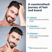 2 Bottles Of Biotin Hair Spray, Deep Moisturizing Hair, Nourishing Scalp Massage Conditioning Foam, Essential Oils Biotin Hair Serum, Unisex, Suitable For People With Poor Hair Quality, 2.03oz - 黑色 - 查看 6