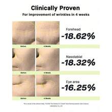 The Retinol 0.1 Cream Vitamina E + Panthenol 20ml | Momento De Aplicación Noche, Maquillaje y Skin Care Amigable para Todo Tipo De Piel - Con Potentes Skincare Activos - Blanco - Ver 6