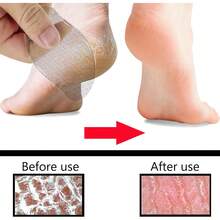 2 lime in vetro per piedi, rimozione calli, scrub per talloni e piedi, pelle morta, scrub per piedi squisito e bello (a forma di mango)