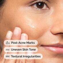 The Ordinary 芦荟 2% + NAG 2% 祛痘印解决方案 - 30ml - 查看 3