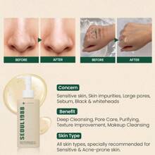 SEOUL1988 Cleansing Oil: Pine Cica 1% + Probiotics 200ML - Cica And Probiotic Cleansing Oil - Cleansing Oil - View 6