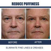 15/30g Men Retinol Anti Wrinkle Eye Cream Firming Lifting Remove Dark Circle Eye Bags Puffy Eye Reduce Fine Line Eye Fat Particle Moisturiz Brighten - Màu xanh lam - Xem 9
