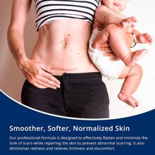 JIU100% Silicone Scar Gel Scar Cream Advanced Scar Gel For Surgical Scars CSection Stretch Marks Acne Injury Burns Keloids Old And New Scars 1.06oz 30g (Maximum Strength 100% Silicone) - 1個(1包) - 查看 6