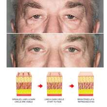 15/30g Men Retinol Anti Wrinkle Eye Cream Firming Lifting Remove Dark Circle Eye Bags Puffy Eye Reduce Fine Line Eye Fat Particle Moisturiz Brighten - Màu xanh lam - Xem 10