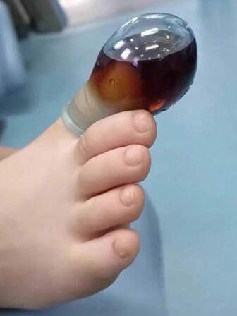 7/14/21/30pcs Medicated Finger Covers For Toe/Finger Injuries, Nail Cover Protectors, Thumb Protectors, Waterproof Bathing Protection Covers, Suitable For Use In Homes And Offices And Other Outdoor Settings; Ideal For Those Who Care About Protecting And Cherishing Their Toes And Fingers; A Thoughtful Gift To Show Care And Long-Lasting Protection For Loved Ones.