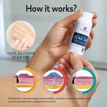 JIU100% Silicone Scar Gel Scar Cream Advanced Scar Gel For Surgical Scars CSection Stretch Marks Acne Injury Burns Keloids Old And New Scars 1.06oz 30g (Maximum Strength 100% Silicone) - 1個(1包) - 查看 8