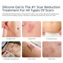JIU100% Silicone Scar Gel Scar Cream Advanced Scar Gel For Surgical Scars CSection Stretch Marks Acne Injury Burns Keloids Old And New Scars 1.06oz 30g (Maximum Strength 100% Silicone) - 1個(1包) - 查看 2