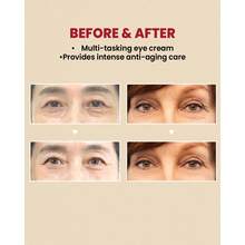 眼霜视黄醇脂质体 4% + 发酵豆，抗皱，抗衰老，皮肤弹性，色素沉着，亮白，视黄醇 - 彩色 - 查看 9