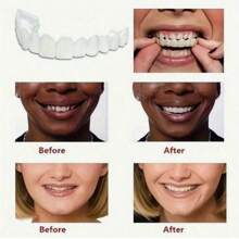 2pcs/4pcs Realistic Teeth Whitening Smile Dental Veneers Set (2pcs Includes 2 Dental Gel And Upper Teeth + Lower Teeth), One-Time Use, One Size Fits All