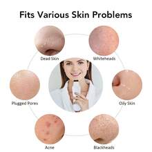 Hailicare Raspador de piel ultrasónico, espátula para la piel facial con 4 modos, removedor de puntos negros y limpiador profundo de poros, extractor de acné facial, herramienta de cuidado de la piel