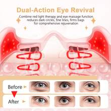 COSYGLOW Under Eyes Red Light Therapy Massager Glasses, Microcurrent Eye Face Red Light Beauty Device, 4D Wrap Around  Eyes Massager Used For Removing Eye Wrinkles, Eye Bags, Fine Lines,Dark Circles,Pink