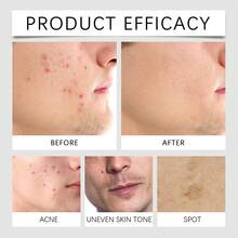 EELHOE Men's No-Makeup Cream Long Lasting Hydrating Oil-Control Concealer Nourishing Improve Rough Dry Skin Moisturizing Brightening Tightening Rejuvenate Face Care Cream - 黑色 - 查看 7