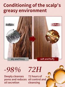 Neutrogena 1瓶（133毫升）露得清去屑、控油、止痒洗发露，清爽洁净，持久留香，适合油性头皮和发痒发质。 - 去屑止癢控油洗髮精133ml - 查看 3