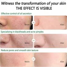 面部精华，改善肤色，提亮肤色，深层滋养并强化皮肤屏障，温和不刺激，平衡、保湿并锁住水分，适合日常护理和晚间护理 - 綠色 - 查看 3