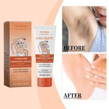 OceAura 50g Body Whitening Bleach Cream Improve Chicken Skin Remove Dark Spots Pigmentation Increase Elasticity Lightening Skin Moisturizing Nourishing For Dark Delicate Underarm Skin Joints - 白色 - 查看 2