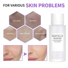 积雪草爽肤水 - 舒缓肌肤、减少发红和炎症、修复屏障、保湿清爽的护肤品 - 銀色 - 查看 5