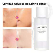 积雪草爽肤水 - 舒缓肌肤、减少发红和炎症、修复屏障、保湿清爽的护肤品 - 銀色 - 查看 1