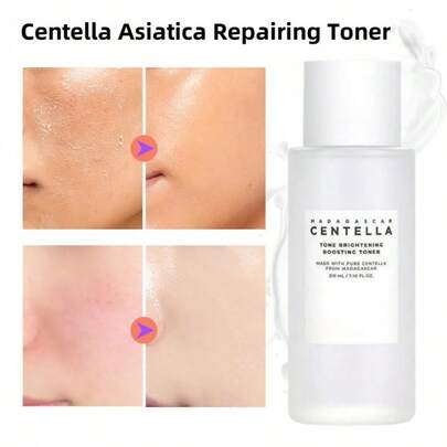 积雪草爽肤水 - 舒缓肌肤、减少发红和炎症、修复屏障、保湿清爽的护肤品