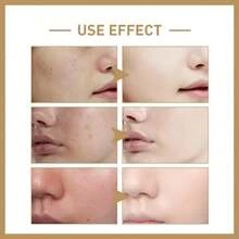 积雪草爽肤水 - 舒缓肌肤、减少发红和炎症、修复屏障、保湿清爽的护肤品 - 銀色 - 查看 2