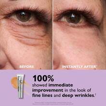 "Instant FirmX Eye Tightener - Temporary Lift Effect - Shop Exclusive" - 1 - Xem 4