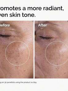 Tónico facial Glycolic Acid 7% The Ordinary 240ml piel mixta/normal exfoliante químico suave mejora textura limpia poros aporta luminosidad rutina belleza vegano uso diario - Toner - Ver 10