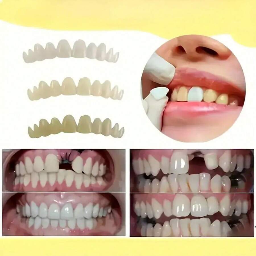 3件套优雅百搭DIY牙齿装饰品，男女皆宜，精美礼品 - 彩色 - 查看 1