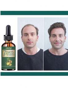 Say Goodbye To Baldness With Our Hair Treatment For Ultimate Thickness And Smoothness  Achieve Full Hair Volume That Stays Flexible And Never Feels Rough  Perfect Solution For Thinning Hair To Regain Confidence With Lush Voluminous Locks Every Day - 彩色 - 查看 1