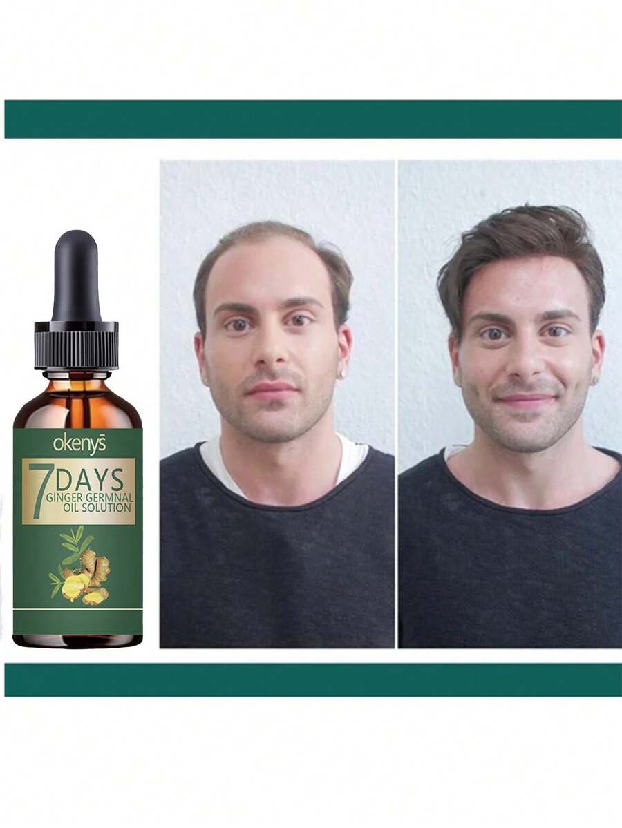 Say Goodbye To Baldness With Our Hair Treatment For Ultimate Thickness And Smoothness  Achieve Full Hair Volume That Stays Flexible And Never Feels Rough  Perfect Solution For Thinning Hair To Regain Confidence With Lush Voluminous Locks Every Day - 彩色 - 查看 1