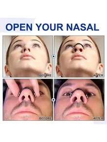 60/10/件磁性鼻呼吸扩张器套装鼻扩张器促进氧气摄入呼吸补充鼻夹鼻贴减少打鼾 - 彩色 - 查看 2