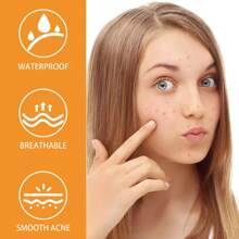 720 parches para acné y granos - Sin alcohol, sin parabenos, sin fragancias, parche limpiador de poros con adhesivo fuerte, apto para todos los tonos de piel clara, incluyendo piel sensible