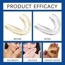 1 Set (Mouthguard + Cleaning Tablets) Portable, Nighttime Teeth Grinding Protection, Soft Silicone Comfort, Teeth Wear Prevention EDTA Disodium, Sodium Bicarbonate & Laureth-7-Containing Nighttime Teeth Care Kit, Dental - Clear - View 10