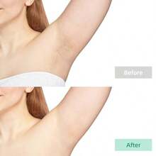 200 Pcs Large Non Woven Wax Strips And 50 Pcs Wooden Wax Sticks Kit, Body And Facial Hair Removal Waxing Strips Soft Waxing Paper Sheets - 如圖 - 查看 6