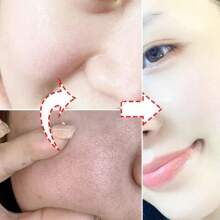 Pore Cleansing Cream - Minimizes Pores, Removes Blackheads, Treats Acne, Brightens Skin, Moisturizes And Smoothens Skin, Skincare