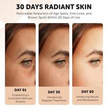 3pcs  Kojic Acid Soap For Hyperpigmentation - With Glutathione, Collagen & Vitamin C - Natural Soap Bars With Turmeric - Original Japanese Complex For Dark Spot Correction - 3 Pack - Nhiều màu - Xem 3