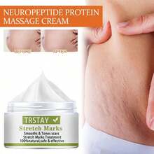 TRSTAY:"StretchFade Repair & Renewal Cream With Collagen, Shea Butter, And Natural Extracts For Smoother, Firmer Skin And Reduced Appearance Of Stretch Marks" - Hyaluronic Acid - Ver 2