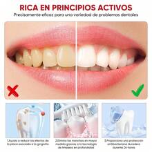 3 Pieza Pasta De Dientes Ultra Blanqueadora Sp-8 - Pasta De Dientes Blanqueadora Con Probiótico Fórmula De Limpieza Profunda, Aliento Fresco, Dientes Saludables Pasta Dental Con Clorhexidina, Pasta Dental White, Higiene Personal Pasta Dental Blanqueadora - Blanco - Ver 8