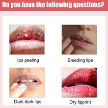 EELHOE 30g Moisturizing Lip Treatment Balm - Moisturizing & Nourishing Care Helps Improve Appearance Of Dryness, Lip Lines And Dark Tones, Supports Smooth Texture With Natural Gloss, Household Size For Daily Lip Care - Đỏ - Xem 10