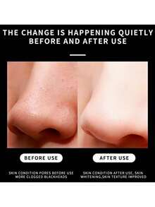 5/10/20/50/100 Disposable Nose Strips, A Skincare Wonder For Shrinking Pores And Removing Blackheads And Acne. They Clean And Restore The Nasal Membrane, Providing A Refreshing And Soothing Sensation. They Help Reduce Excess Oil On The Nose And Are Suitable For Cleaning Blackheads And Clogging Pores. They Are Ideal For Both Men And Women And Are Perfect For Christmas And Holiday Gifts