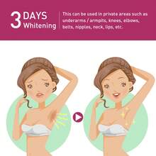 3-Piece Set,Skin Bleaching Cream For Body-Dark Spots Remover Lightening Cream & Uneven Tone Nourishing Formula Bleaching Intimate Areas & Underarms Inner Thigh, Bikini Line, Armpit Knees Elbows For All Skin Types-Valentines Gifts,Birthday,Gifts For Women,Mardi Gras - màu đen - Xem 6