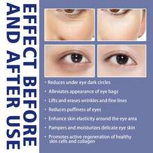 JAYSUING Active Eye Cream Reduces Fine Lines, Eye Bags, Dark Circles, Moisturizes And Tightens The Skin Around The Eyes, Anti Wrinkle Eye Cream - 白色 - 查看 6