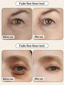 Facial Masks - Eye Mask - View 6