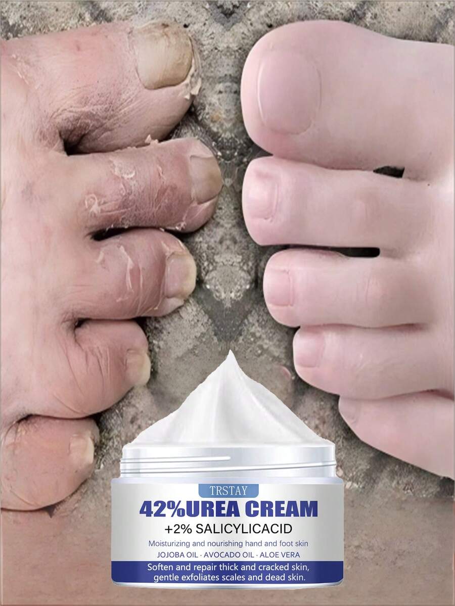 TRSTAY: Moisturizing And Nourishing Hand And Foot Moisturizer, Softening And Repairing Thick And Cracked Skin, Gently Removing Scales And Dead Skin.