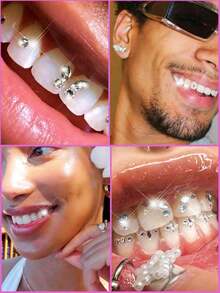 200pcs Self-Adhesive DIY Tooth Gems Set, Fashion Tooth Jewelry, Crystal Rhinestones, Super Shiny White Tooth Decor, Butterfly Flat Diamonds, Dental Beauty Materials Kit, European & American Hip-Hop Goth Y2K Style, Includes All Tools - Tooth Jewelry Set - View 9