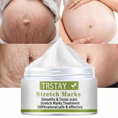 TRSTAY:"StretchFade Repair & Renewal Cream With Collagen, Shea Butter, And Natural Extracts For Smoother, Firmer Skin And Reduced Appearance Of Stretch Marks"