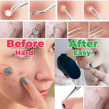 8-Piece Needle Set, Cell Clip, Blackhead Remover, Ultra-Fine Tweezers, Professional Beauty Salon, High-Precision Needle, Cleaning Clip Set - 銀色1套 - 查看 5