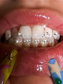 200pcs Self-Adhesive DIY Tooth Gems Set, Fashion Tooth Jewelry, Crystal Rhinestones, Super Shiny White Tooth Decor, Butterfly Flat Diamonds, Dental Beauty Materials Kit, European & American Hip-Hop Goth Y2K Style, Includes All Tools - Tooth Jewelry Set - View 3