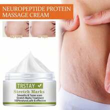 TRSTAY:"StretchFade Repair & Renewal Cream With Collagen, Shea Butter, And Natural Extracts For Smoother, Firmer Skin And Reduced Appearance Of Stretch Marks" - Hyaluronic Acid - Ver 3