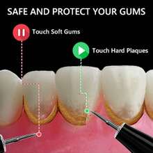 1 Set Electric Tartar Eraser With LED Light, Tartar Eraser Cleaning Tool, 4 Replaceable Blades And 4 Dental Care Modes For Cleaning Teeth And Removing Tartar From Teeth, Father's Day Mother's Day Valentine's Day Gift (USB Rechargeable) - 黑色 - 查看 9